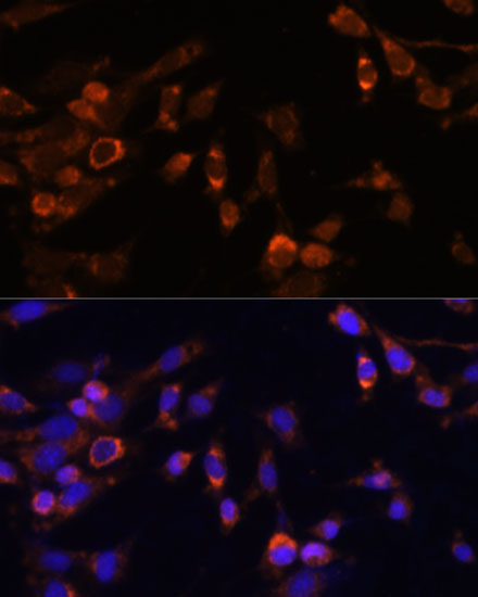 PSMB7 Rabbit Polyclonal Antibody - Image 3