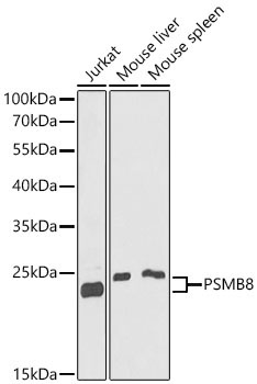 PSMB8 Rabbit Polyclonal Antibody