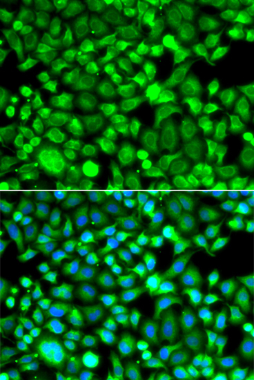 PSMB8 Rabbit Polyclonal Antibody - Image 2