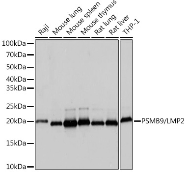 PSMB9/LMP2 Rabbit Monoclonal Antibody