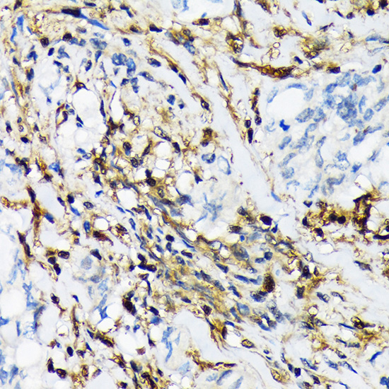 PSMB9/LMP2 Rabbit Monoclonal Antibody - Image 2