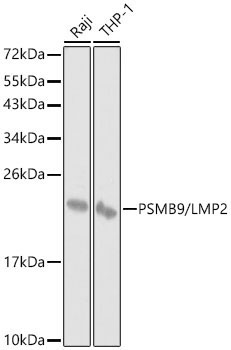 PSMB9/LMP2 Rabbit Polyclonal Antibody