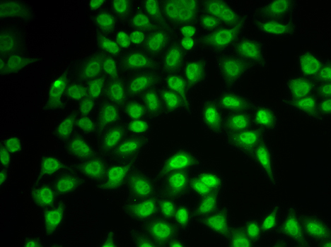 PSMB9/LMP2 Rabbit Polyclonal Antibody - Image 2