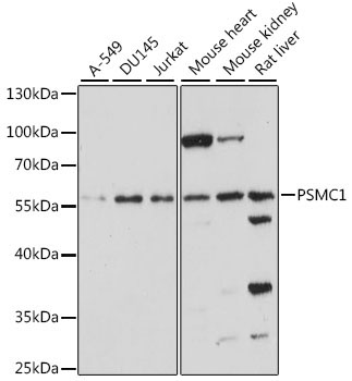 PSMC1 Rabbit Polyclonal Antibody