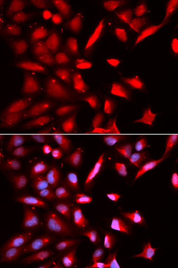 PSMC3 Rabbit Polyclonal Antibody - Image 2