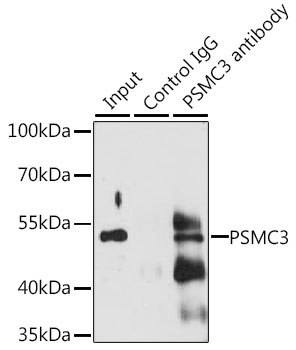 PSMC3 Rabbit Polyclonal Antibody - Image 3