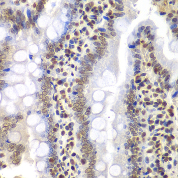 PSMC3 Rabbit Polyclonal Antibody - Image 2