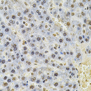 PSMC3 Rabbit Polyclonal Antibody - Image 3