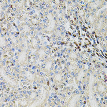 PSMC3 Rabbit Polyclonal Antibody - Image 4