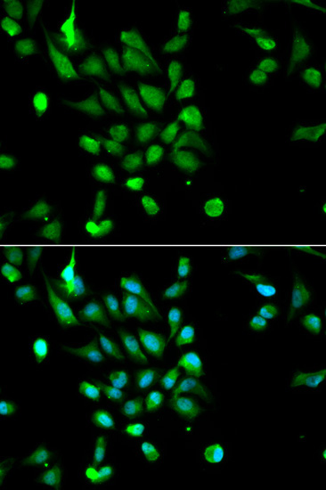 PSMC5 Rabbit Polyclonal Antibody - Image 2