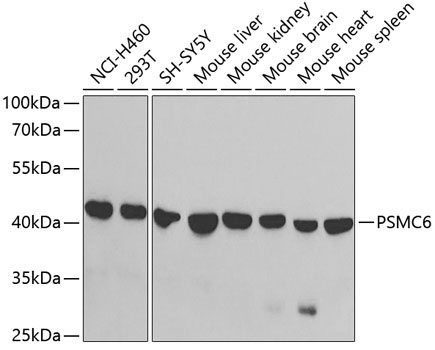 PSMC6 Rabbit Polyclonal Antibody