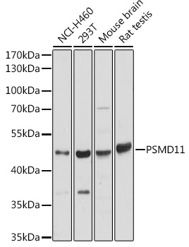PSMD11 Rabbit Polyclonal Antibody