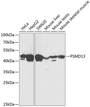 PSMD13 Rabbit Polyclonal Antibody