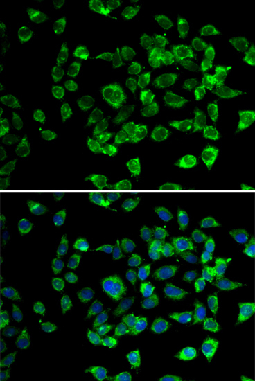 PSMD13 Rabbit Polyclonal Antibody - Image 2