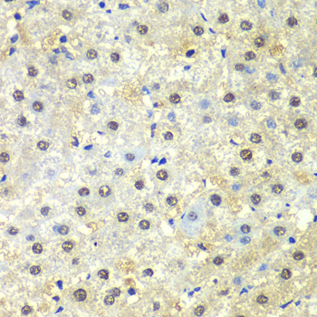 PSMD13 Rabbit Polyclonal Antibody - Image 2