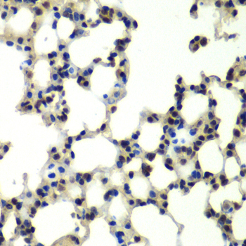 PSMD13 Rabbit Polyclonal Antibody - Image 3