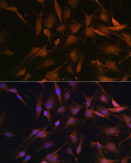 PSMD13 Rabbit Polyclonal Antibody - Image 4