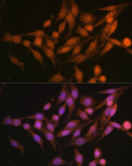 PSMD13 Rabbit Polyclonal Antibody - Image 5