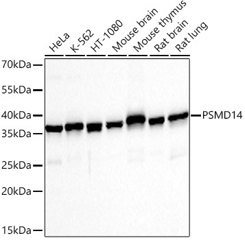 PSMD14 Rabbit Monoclonal Antibody