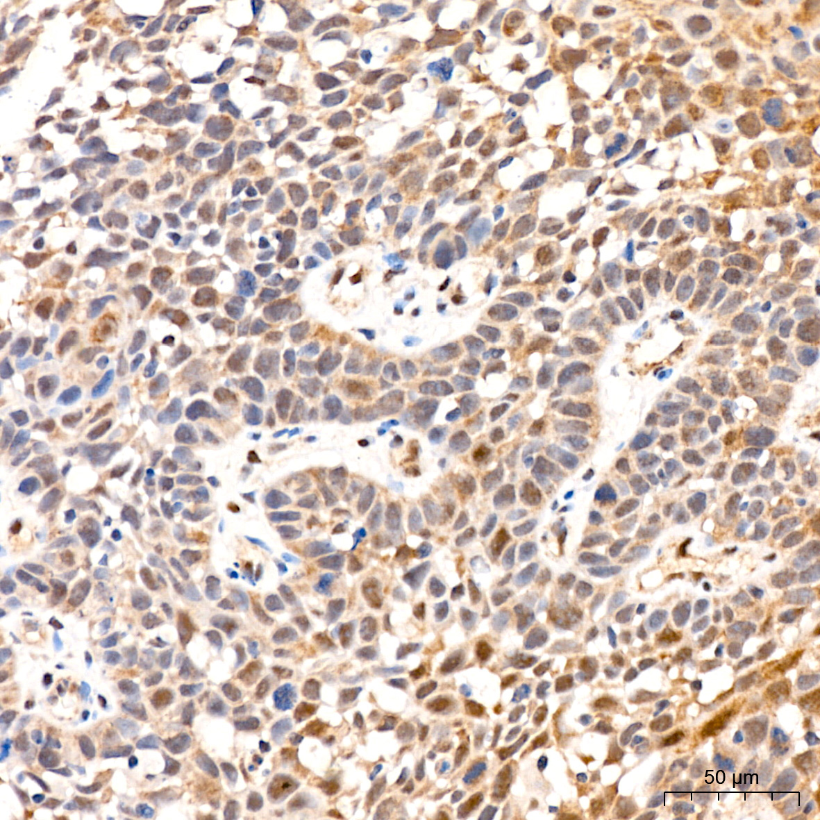 PSMD14 Rabbit Monoclonal Antibody - Image 2