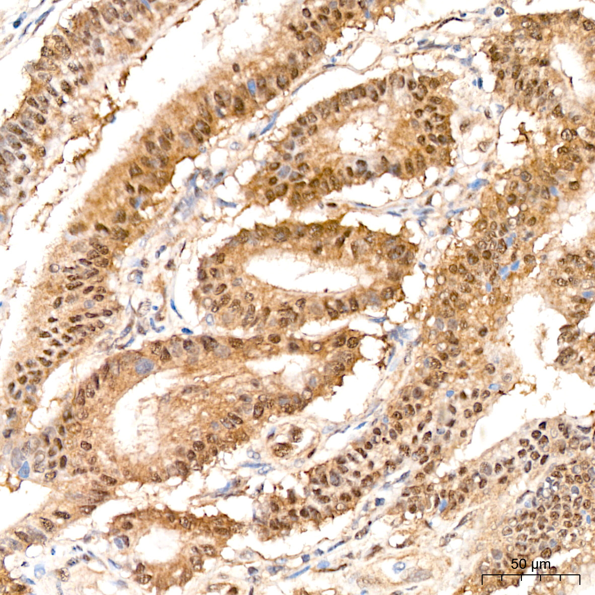 PSMD14 Rabbit Monoclonal Antibody - Image 3