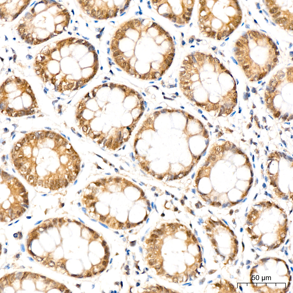 PSMD14 Rabbit Monoclonal Antibody - Image 4