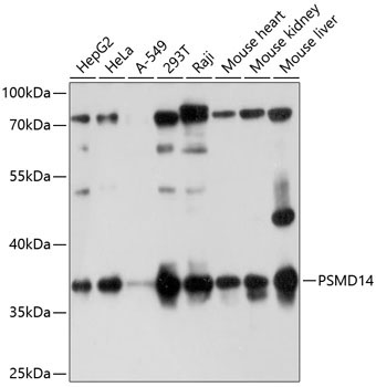 PSMD14 Rabbit Polyclonal Antibody