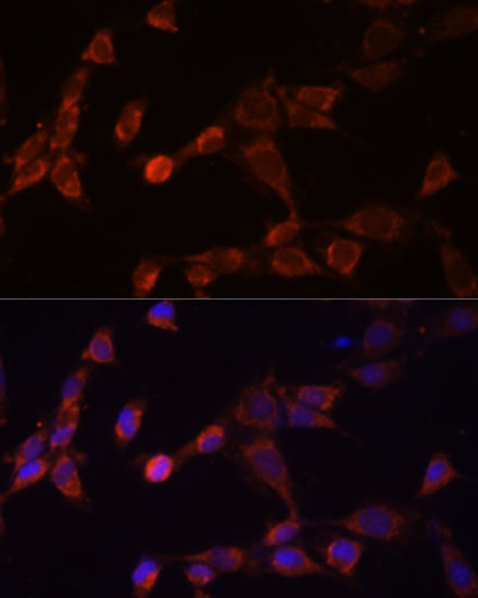 PSMD14 Rabbit Polyclonal Antibody - Image 2