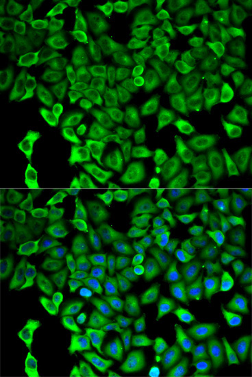 PSMD2 Rabbit Polyclonal Antibody - Image 2