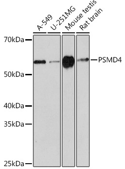 PSMD4 Rabbit Monoclonal Antibody