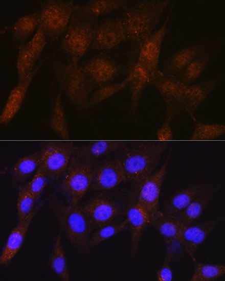 PSMD4 Rabbit Monoclonal Antibody - Image 2