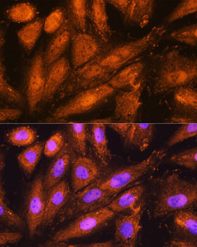 PSMD4 Rabbit Polyclonal Antibody - Image 2