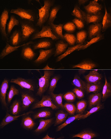 PSMD4 Rabbit Polyclonal Antibody - Image 3