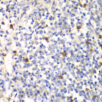 PSMD7 Rabbit Polyclonal Antibody - Image 2