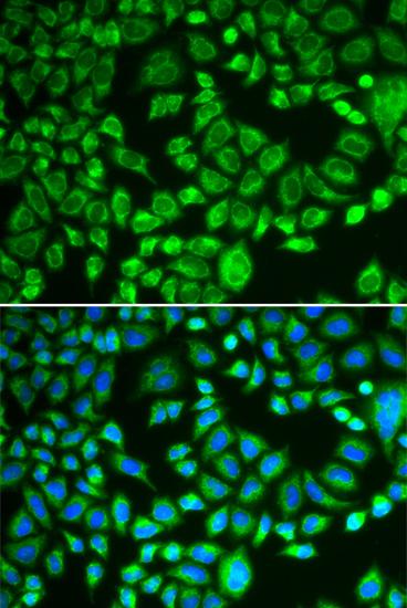 PSMD7 Rabbit Polyclonal Antibody - Image 3