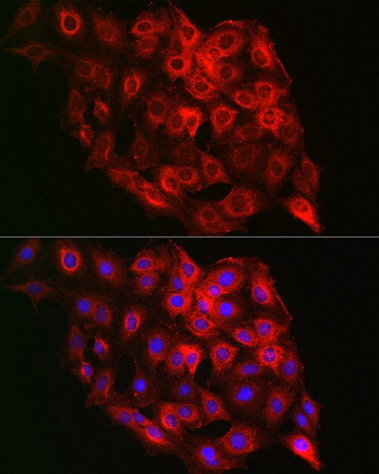 PSMD8 Rabbit Polyclonal Antibody - Image 2