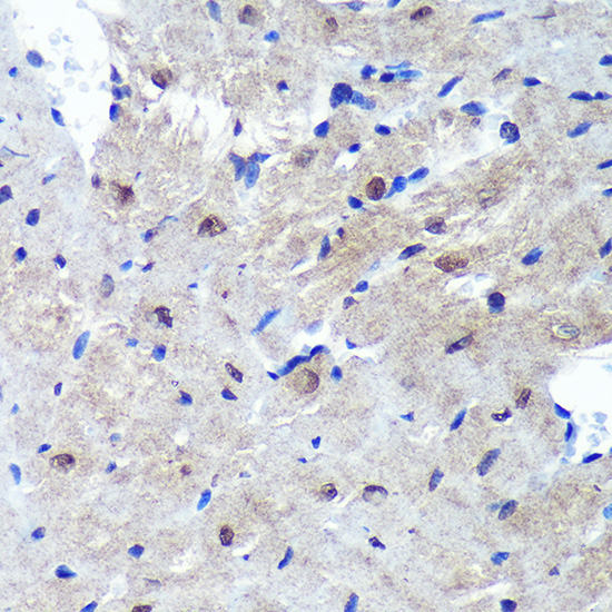 PSME4 Rabbit Polyclonal Antibody - Image 2
