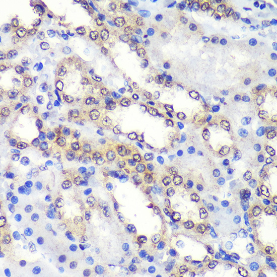 PSME4 Rabbit Polyclonal Antibody - Image 3