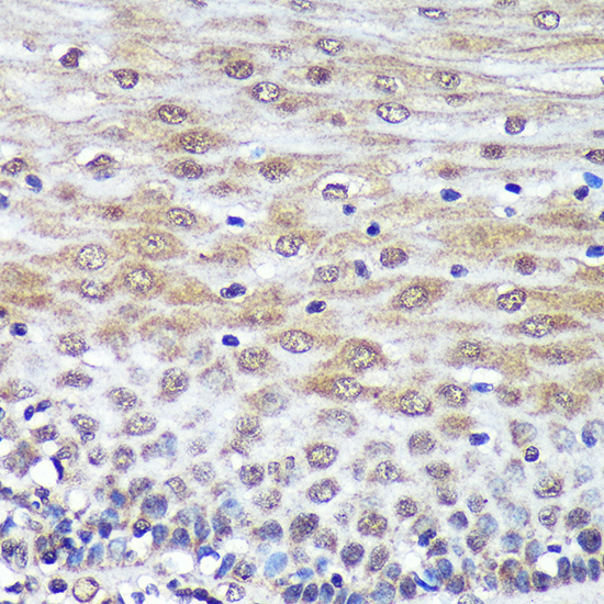 PSME4 Rabbit Polyclonal Antibody - Image 4