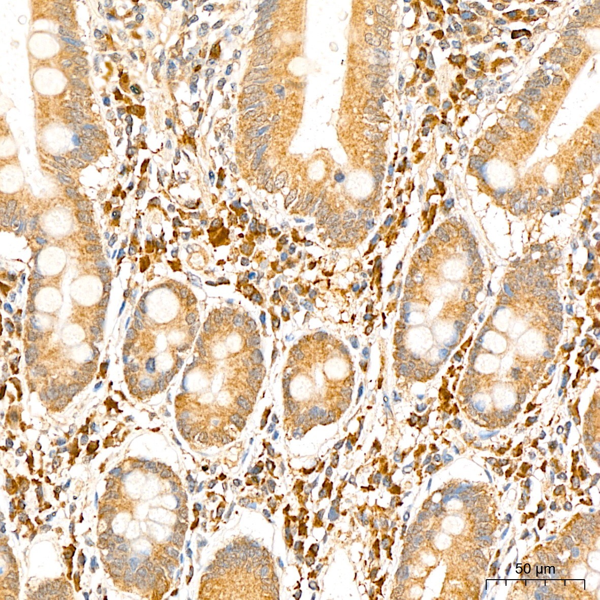 PSMF1 Rabbit Polyclonal Antibody - Image 2
