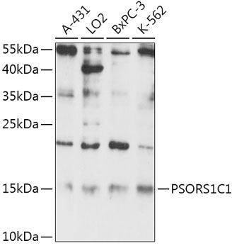 PSORS1C1 Rabbit Polyclonal Antibody