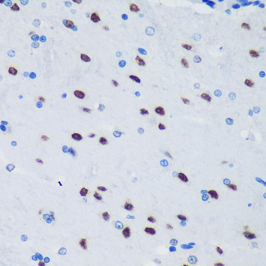 PSPC1 Rabbit Polyclonal Antibody - Image 3
