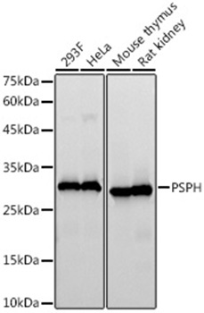 PSPH Rabbit Monoclonal Antibody