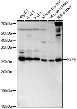 PSPH Rabbit Polyclonal Antibody