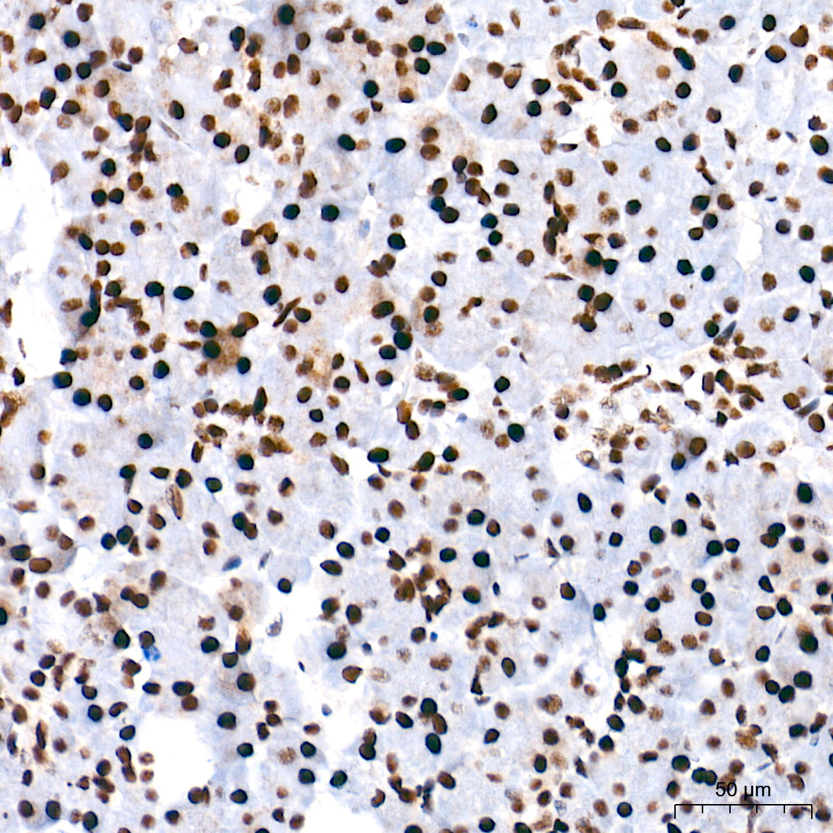 PTBP1 Rabbit Monoclonal Antibody - Image 2