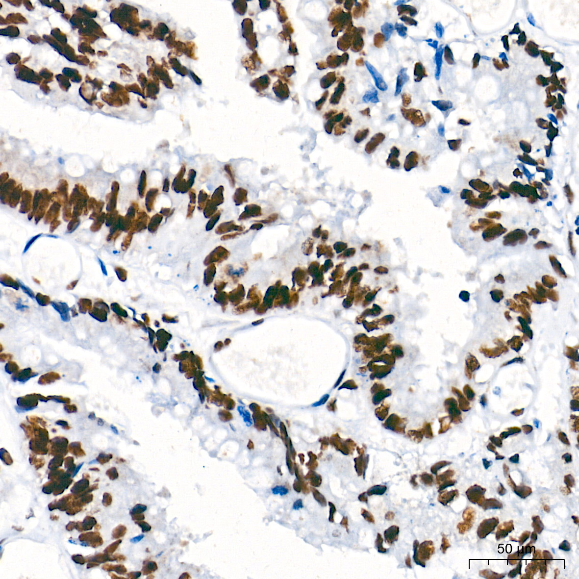 PTBP1 Rabbit Monoclonal Antibody - Image 3