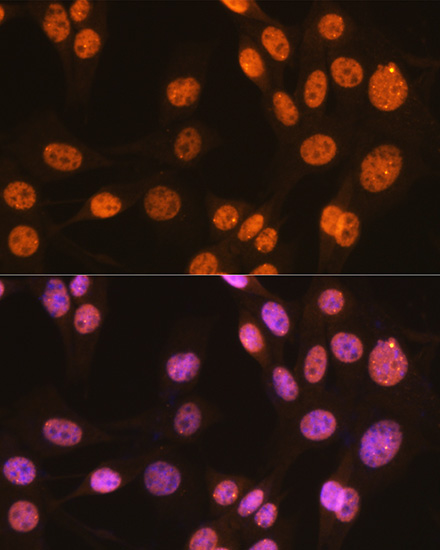 PTBP1 Rabbit Monoclonal Antibody - Image 4