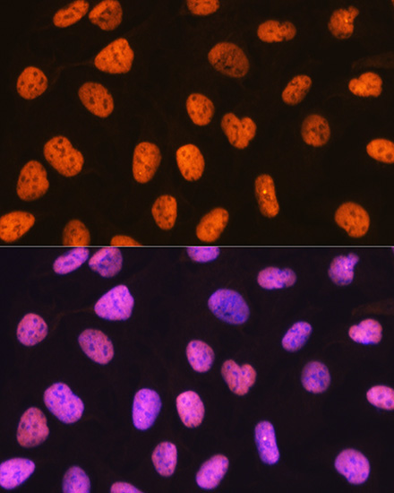 PTBP1 Rabbit Monoclonal Antibody - Image 5