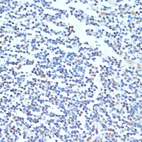 PTBP1 Rabbit Polyclonal Antibody - Image 3
