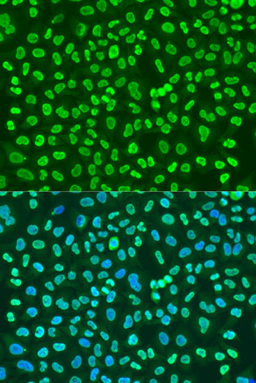 PTBP1 Rabbit Polyclonal Antibody - Image 4